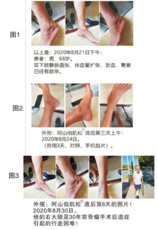 千年智慧与现代科学的抗癌新纪元: 何金山的破壁之路